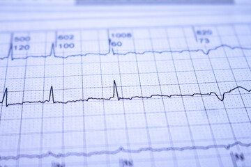 Heartbeat recorded on EKG paper. Study of the heart.