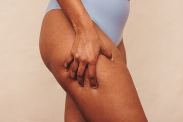 Closeup of an anonymous woman grabbing her thigh in a studio - obrazy, fototapety, plakaty