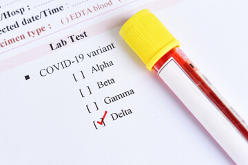 Delta variant COVID-19 positive, blood sample positive with delta variant or Indian strain of...