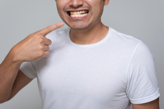 Hispanic-looking Mexican man with yellow teeth, Chinese-haired young man in white shirt with gray background back, points his finger to his mouth
