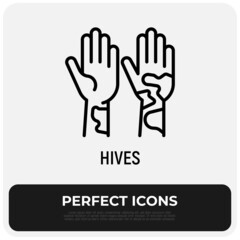 Hives on hand thin line icon. Allergy symptom. Modern vector illustration of allergic reaction.