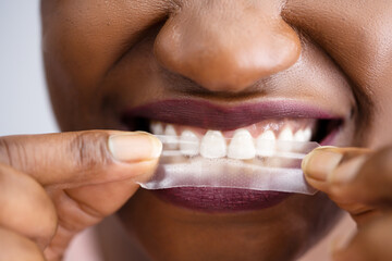 Teeth Whitening Strip