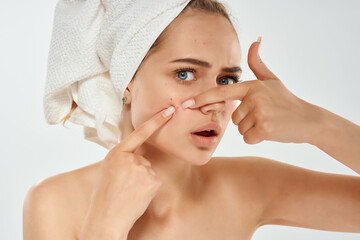 woman with bare shoulders with a towel on her head squeezes out pimples and dermatology hygiene