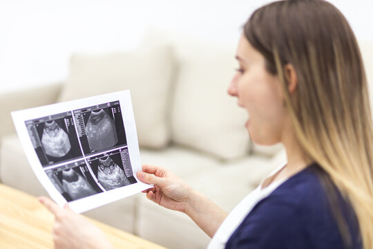 Photo of pregnant woman holding ultrasound report at home.