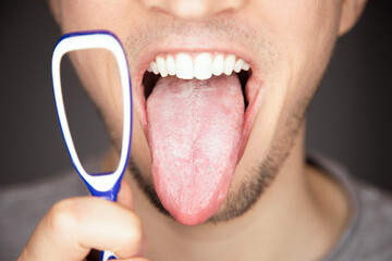 white covered and coated tongue out with tiny bumps is indicator for sickness and infections and...