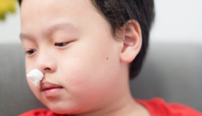 asian little boy nosebleed with gauze pack to stop epistaxis