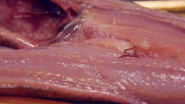 魚に寄生するシュードテラノーバ　	アニサキス症のイメージ素材