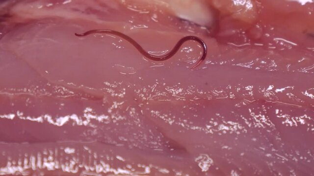 魚に寄生するシュードテラノーバ　	アニサキス症のイメージ素材