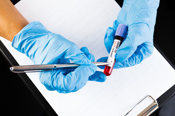 blood test in the hands of the doctor .blood  test with the label Covid-19 DELTA Variant.