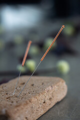 Acupuncture needles in a doctor's office. Traditional Chinese medicine elements.