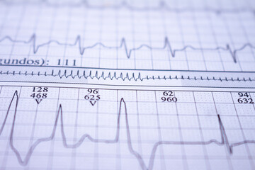 Electrocardiogram beats recorded on paper. Closeup to heart beat.