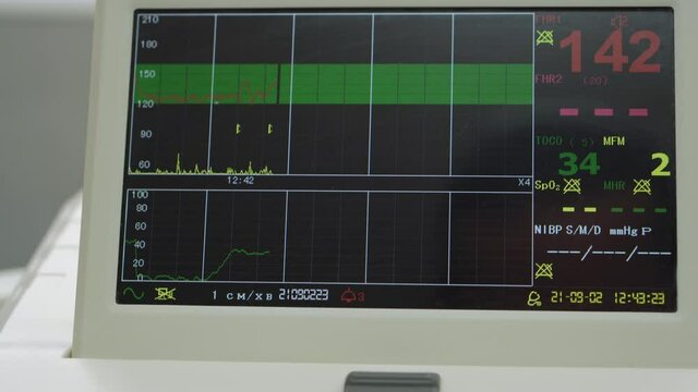 Electronic Cardiotocography Machine Monitoring Fetal Heart Contractions Of Uterus. Printing Cardiogram Report Coming Out Electrocardiogram In Labor Ward During Pregnancy. Medical Diagnostic Equipment