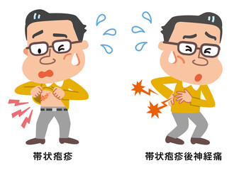 帯状疱疹と帯状疱疹後神経痛の中年男性のイラスト