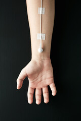 Male arm with earphone attached as medical serum. Music is my life or audiophile addiction - obrazy, fototapety, plakaty