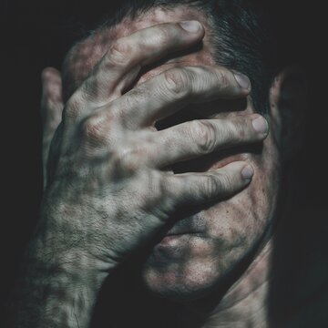 man covering his face with his hand