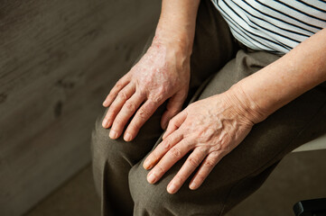 The hands of an elderly woman.
