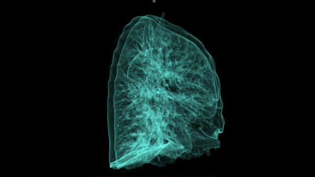 3d chest ct scan moving lung anatomy 