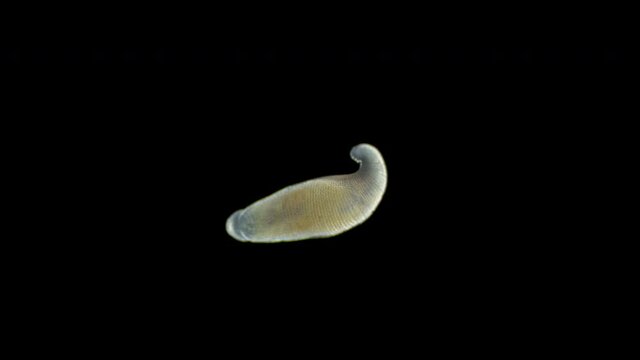 Leech Helobdella stagnalis under a microscope, family Glossiphoniidae, order Rhynchobdellida. Sample size 5 mm. Lives in fresh water, eats: worms, insect larvae, gastropod snails.