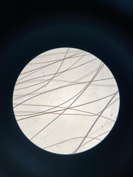 closeup photo of cat hair under microscope