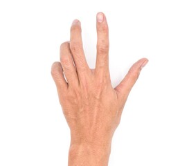 Volkmann&rsquo;s contracture in Southeast Asian young man.