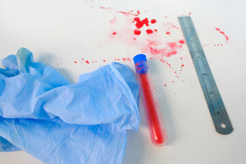 fresh splatter of red blood on white table, crime scene stains, blood sample collection tube,...