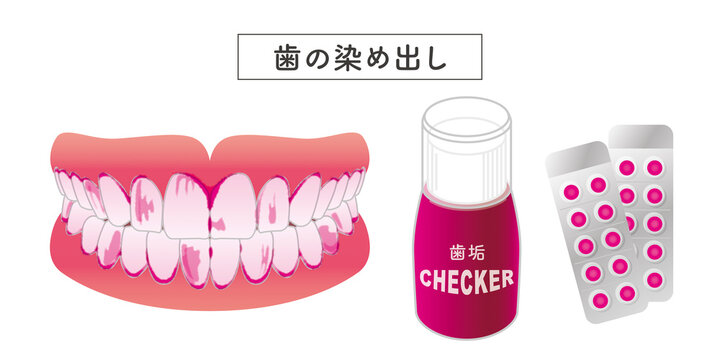 歯垢の染め出し　セットイラスト