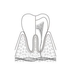 奥歯の内部構造イラスト