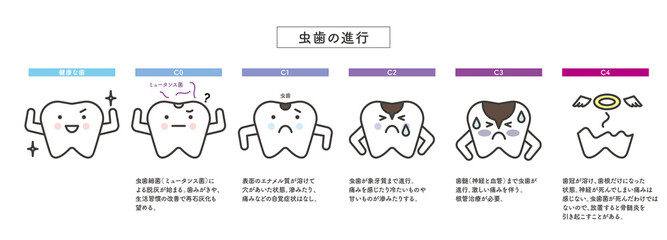 シンプル　イラスト　虫歯の進行　歯のキャラクター