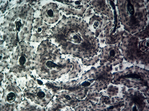 Histology image of compact osseous (bone) tissue showing osteons and osteocytes (100x)