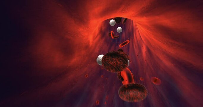 Sick Unhealthy Red Blood Cells Flowing Inside Human Vein. Health Problem. Perfect Loop. Science And Health Related High Quality 3D Animation.