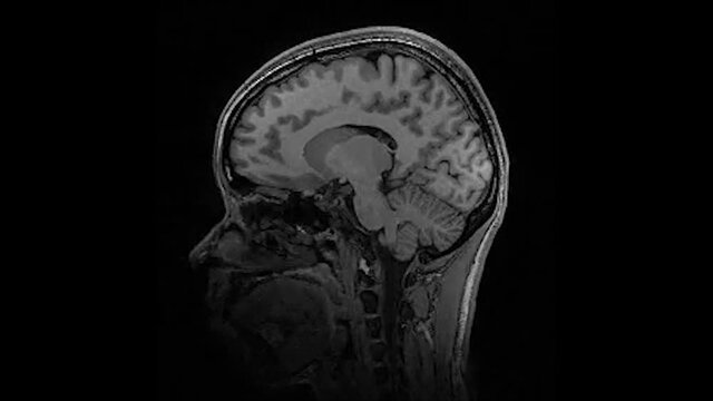 Human brain MRI on Black Background 4k footage