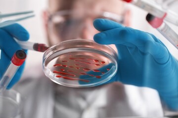 Scientist Works with Petri Dishes with Bacteria, Tissue and Blood Samples. Concept of...