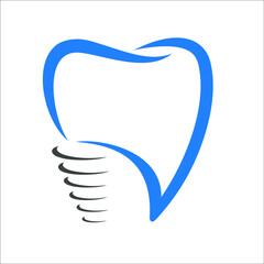 tooth implant