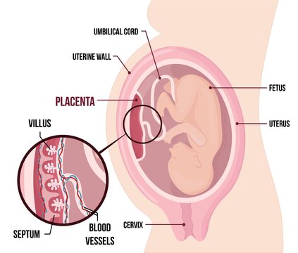 Human Fetus Placenta Anatomy. Usual anatomical Placenta Location During Pregnancy.