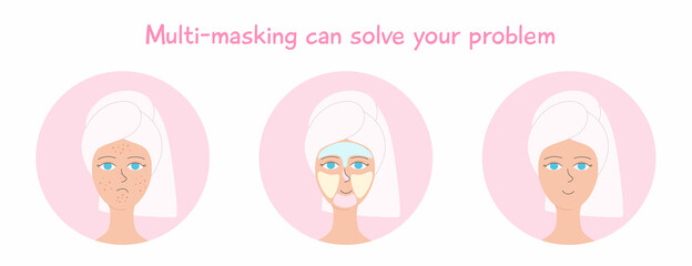 A girl with a towel on her head gets rid of acne using multimasking. Vector illustration of skincare.