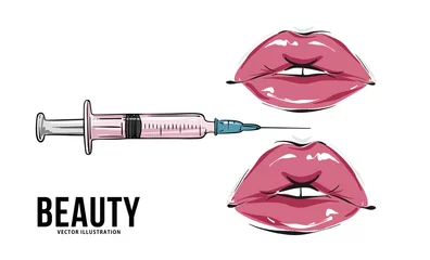 Fotobehang Lips injection makeup art, lip fillers, hyaluronic acid vector art  mouth underskin cosmetic © milatoo