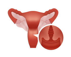 Realistic reproductive system with close-up cross-section. Female human reproductive system with focus on cervix.