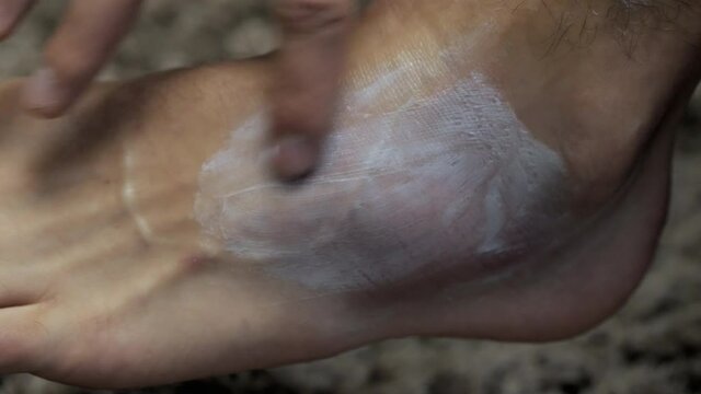 Close-up of smearing healing cream a bruise on the foot, a sprain and a bruise on the leg, the concept of rehabilitation and treatment of injuries
