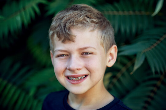 Portrait of a boy with braces in nature .