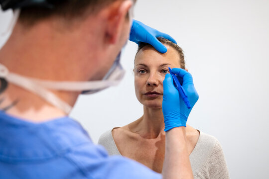 Surgeon drawing line on girl eye with marker preparing for procedure.