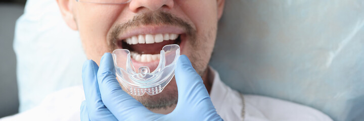 Dentist trying on mouthguard for man patient - obrazy, fototapety, plakaty