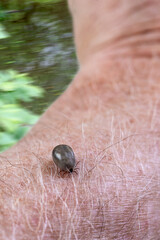 Close-up of a tick crawling on a human skin.