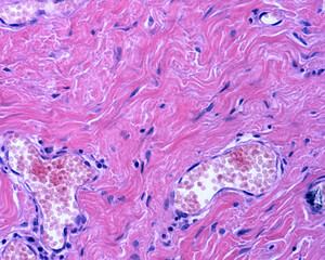 Skin. Dermis reticular