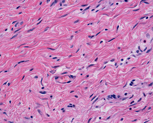 Skin. Dermis reticular