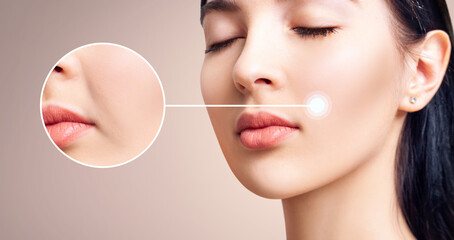 Young woman with zoom circles before and after wrinkles treatment.