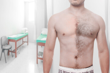 Man waxing his chest to depilate hair half body at modern spa relax - obrazy, fototapety, plakaty
