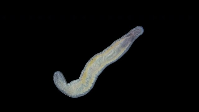 Young Worm Nemertea Prostoma sp. under the microscope, of the Tetrastemmatidae family. Freshwater species, predator.