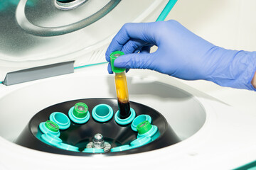 A hand in a blue medical glove pulls out a test tube with blood plasma from the centrifuge. soncept of laboratory blood tests and cosmetological injections of beauty of skin and hair