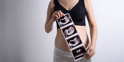 Pregnant woman in white and black underwear. Young woman expecting a baby. Front view hand holding ultrasound image photo.