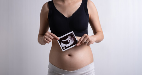 Pregnant woman in white and black underwear. Young woman expecting a baby. Front view hand holding ultrasound image photo.